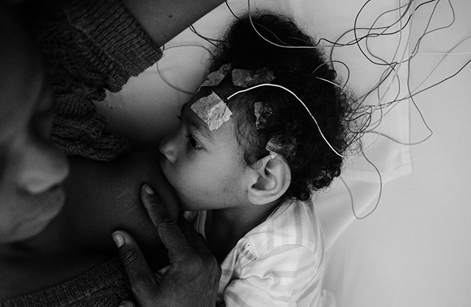 Imagen La vida después del Zika: el desafío de criar a los bebés con microcefalia en Cali